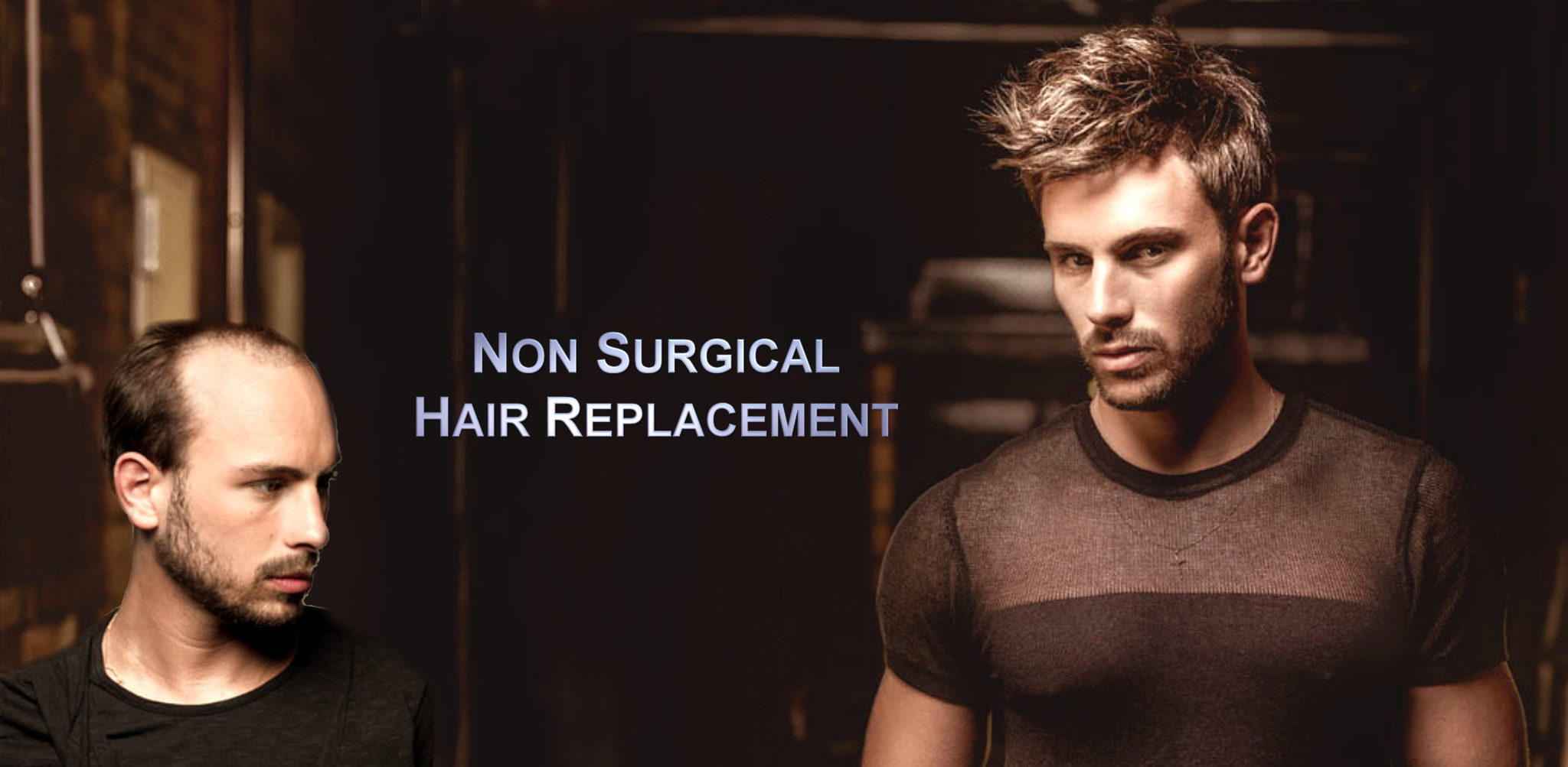 Non Surgical Hair Transplant For Men At The Hair Clinic Montreal 